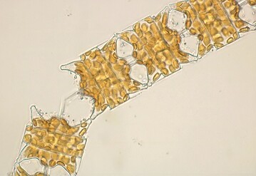 Nur unter dem Mikroskop zu bestimmen: kleine Algenarten wie die dargestellte Kieselalge (Odontella aurita) knnen stoffliche Belastungen im Wattenmeer sichtbar machen 