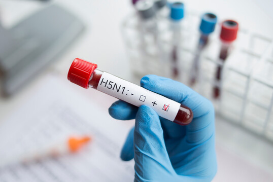 Auch im US-Bundesstaat Idaho fielen erste Tests auf das H5N1-Influenzavirus bei Milchkühen positiv aus.