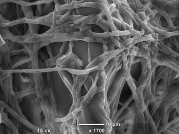 Elektronenmikroskopische Aufnahme: Pilzmyzelien von 
<i>Fusarium </i>
besiedeln einen Kunststoffpartikel.