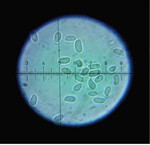 Abb. 4: Viele Pilzarten lassen sich anhand makroskopischer Merkmale nicht bestimmen, es bedarf einer Betrachtung der Sporen per Mikroskop wie hier beim Gemeinen Samtfußrübling (Flammulina velutipes).