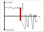 Abb. 8: Systemische Darstellung: Landschaftliche Entwicklung vor und nach Überschreiten des Tipping Points ( Schmidt 2020: 202).